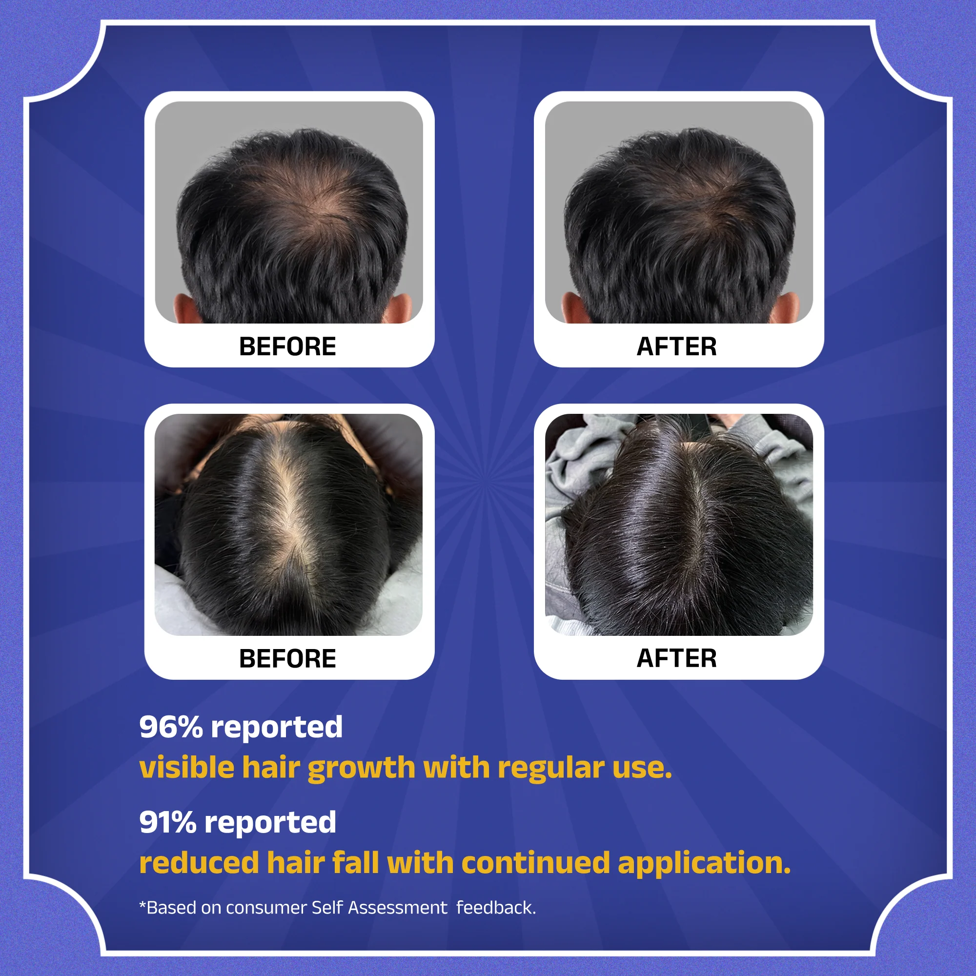 Rockstar Advanced Hair Growth Serum - Image 10